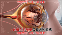 cctv-1hd